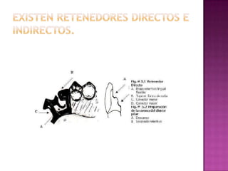EXISTEN RETENEDORES DIRECTOS E INDIRECTOS.