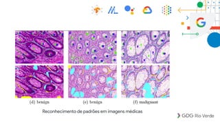 Reconhecimento de padrões em imagens médicas
 