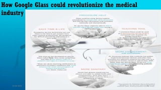 How Google Glass could revolutionize the medical
industry
15-04-2014 30
 