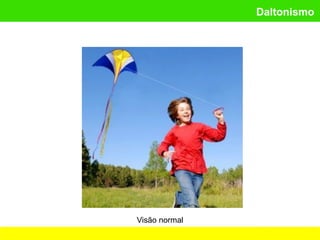 Daltonismo
Visão normal
 