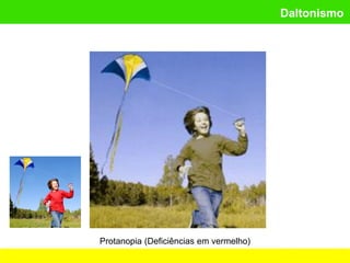 Daltonismo
Protanopia (Deficiências em vermelho)
 