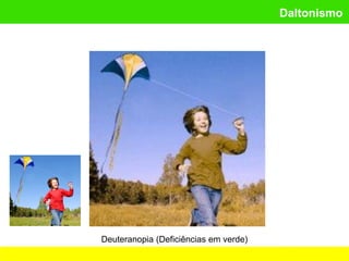 Daltonismo
Deuteranopia (Deficiências em verde)
 