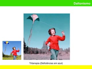Daltonismo
Tritanopia (Deficiências em azul)
 