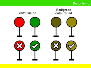 Daltonismo
 