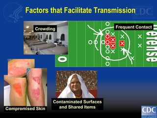 Frequent Contact
Contaminated Surfaces
and Shared Items
Crowding
Factors that Facilitate Transmission
Compromised Skin
 