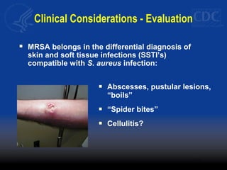 Clinical Considerations - Evaluation
 MRSA belongs in the differential diagnosis of
skin and soft tissue infections (SSTI’s)
compatible with S. aureus infection:
 Abscesses, pustular lesions,
“boils”
 “Spider bites”
 Cellulitis?
 