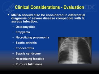 Clinical Considerations - Evaluation
 MRSA should also be considered in differential
diagnosis of severe disease compatible with S.
aureus infection:
– Osteomyelitis
– Empyema
– Necrotizing pneumonia
– Septic arthritis
– Endocarditis
– Sepsis syndrome
– Necrotizing fasciitis
– Purpura fulminans
 
