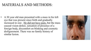 MATERIALS AND METHODS:
• A 30 year old man presented with a mass in his left
eye that was present since birth and gradually
increased in size . He did not have pain, but the mass
caused vision defect, sensation of presence of a
foreign body, discomfort on blinking and cosmetic
disfigurement. There was no family history of
similar lesion.
 