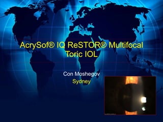 AcrySof® IQ ReSTOR® Multifocal Toric IOL Con Moshegov Sydney 