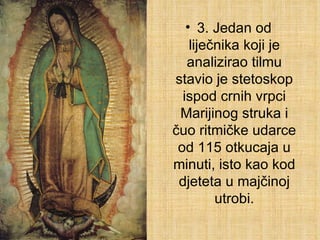 3. Jedan od liječnika koji je analizirao tilmu stavio je stetoskop ispod crnih vrpci Marijinog struka i čuo ritmičke udarce od 115 otkucaja u minuti, isto kao kod djeteta u majčinoj utrobi. 
