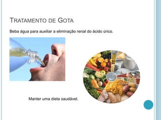 TRATAMENTO DE GOTA
Beba água para auxiliar a eliminação renal do ácido úrico.
Manter uma dieta saudável.
 
