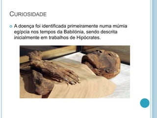 CURIOSIDADE
 A doença foi identificada primeiramente numa múmia
egípcia nos tempos da Babilónia, sendo descrita
inicialmente em trabalhos de Hipócrates.
 