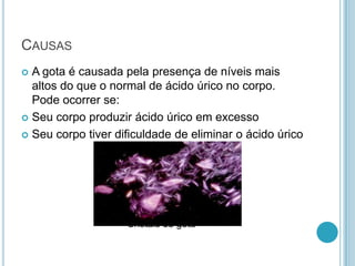 CAUSAS
 A gota é causada pela presença de níveis mais
altos do que o normal de ácido úrico no corpo.
Pode ocorrer se:
 Seu corpo produzir ácido úrico em excesso
 Seu corpo tiver dificuldade de eliminar o ácido úrico
Cristais de gota
 
