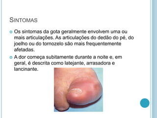 SINTOMAS
 Os sintomas da gota geralmente envolvem uma ou
mais articulações. As articulações do dedão do pé, do
joelho ou do tornozelo são mais frequentemente
afetadas.
 A dor começa subitamente durante a noite e, em
geral, é descrita como latejante, arrasadora e
lancinante.
 