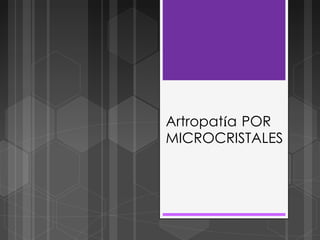 Artropatía POR
MICROCRISTALES
 