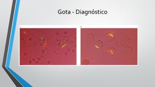 Gota - Diagnóstico
 