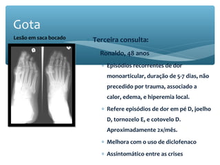 ∗ Terceira consulta:
∗ Ronaldo, 48 anos
∗ Episódios recorrentes de dor
monoarticular, duração de 5-7 dias, não
precedido por trauma, associado a
calor, edema, e hiperemia local.
∗ Refere episódios de dor em pé D, joelho
D, tornozelo E, e cotovelo D.
Aproximadamente 2x/mês.
∗ Melhora com o uso de diclofenaco
∗ Assintomático entre as crises
Gota
Lesão em saca bocado
 