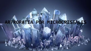 ARTROPATIA POR MICROCRISTALES
 