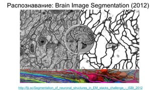 Распознавание: Brain Image Segmentation (2012)
http://fiji.sc/Segmentation_of_neuronal_structures_in_EM_stacks_challenge_-_ISBI_2012
 
