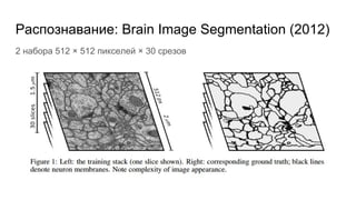 Распознавание: Brain Image Segmentation (2012)
2 набора 512 × 512 пикселей × 30 срезов
 