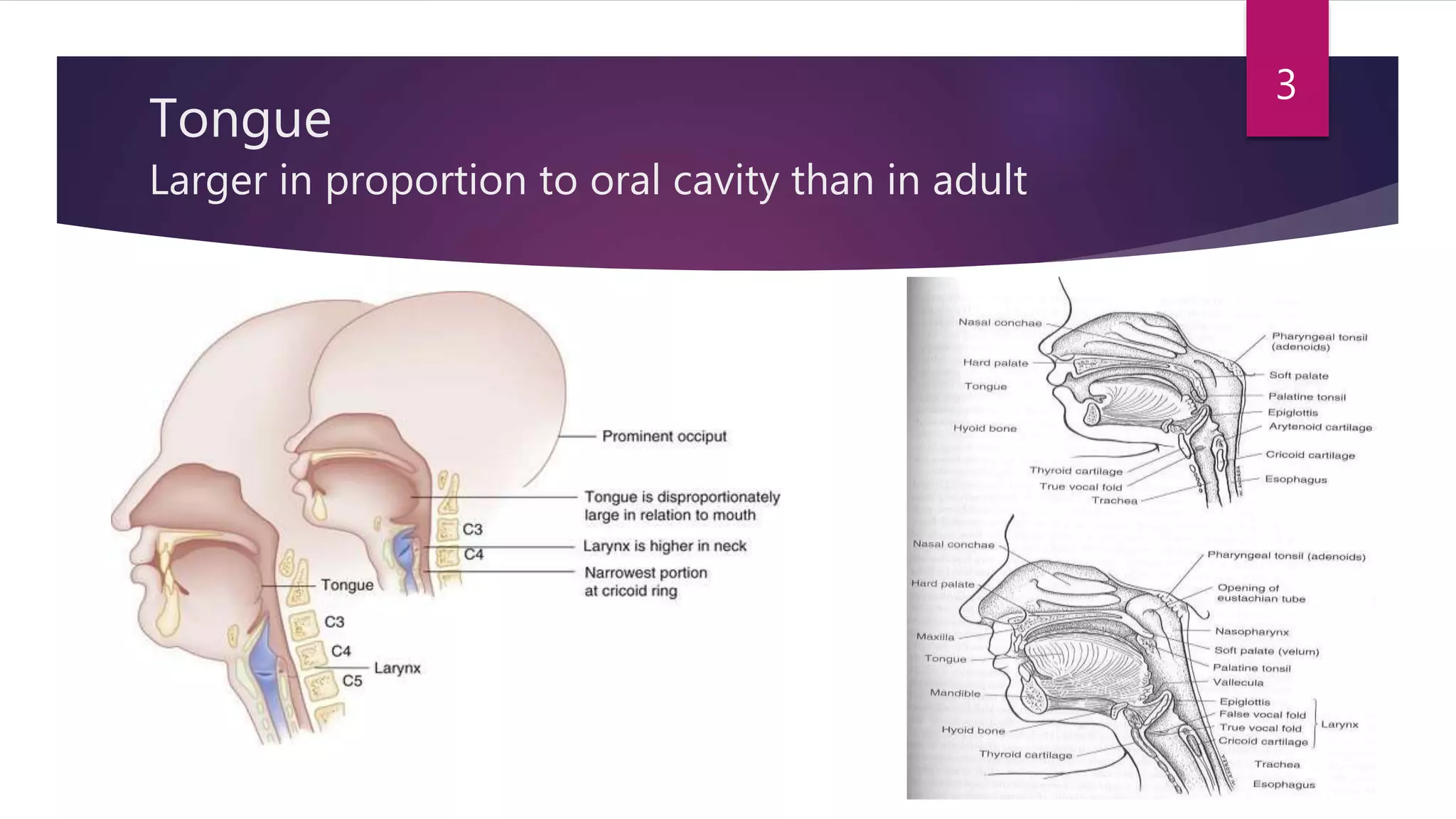 Tongue
Larger in proportion to oral cavity than in adult
3