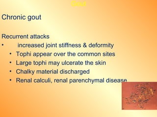 Gout | PPT
