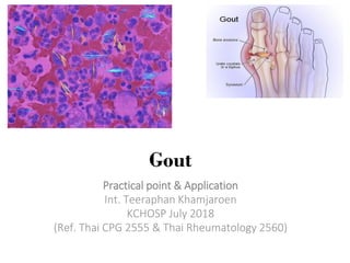 Gout
Practical point & Application
Int. Teeraphan Khamjaroen
KCHOSP July 2018
(Ref. Thai CPG 2555 & Thai Rheumatology 2560)
 