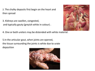 2. The chalky deposits first begin on the heart and
then spread
3. Kidneys are swollen, congested,
and typically gouty (greyish white in colour) .
4. One or both ureters may be distended with white material.
5.In the articular gout, when joints are opened,
the tissue surrounding the joints is white due to urate
deposition
 