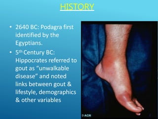 Gout - Clinical features , diagnosis and management | PPTX