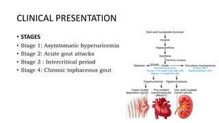 CLINICAL PRESENTATION
• STAGES
• Stage 1: Asymtomatic hyperuricemia
• Stage 2: Acute gout attacks
• Stage 3 : Intercritical period
• Stage 4: Chronic tophaceous gout
 
