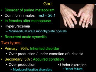 Gout
• Disorder of purine metabolism
• Common in males m:f = 20:1
• In females after menopause
• Hyperurecemia
– Monosodium urate monohydrate crystals
• Recurrent acute synovitis
Two types:
• Primary 95%: Inherited disorder
• Over production / under excretion of uric acid
• Secondary 5% : Acquired condition
• Over production
• Myeloproliferative disorders
• Under excretion
• Renal failure
 