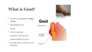 What is Gout? Homeopathy Remedies and Natural Relief Explained | PPTX