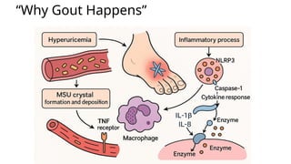 Gout | PPTX