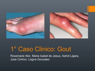 1° Caso Clinico: Gout
Rosemarie Alor, Maria Isabel de Jesus, Astrid Lajara,
Jose Cintron, Legna Gonzalez
 