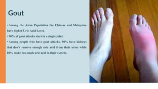 Gout
• Among the Asian Population the Chinese and Malaysian
have higher Uric Acid Level.
• 90% of gout attacks start in a single joint.
• Among people who have gout attacks, 90% have kidneys
that don’t remove enough uric acid from their urine while
10% make too much uric acid in their system.
 