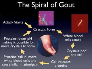 gout vs pseudogout crystals