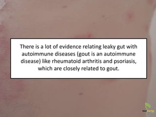 There is a lot of evidence relating leaky gut with
autoimmune diseases (gout is an autoimmune
disease) like rheumatoid arthritis and psoriasis,
which are closely related to gout.
 