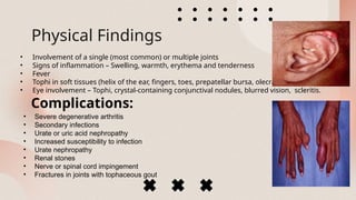 Gout Disease Pharmacology and Medicine.pptx