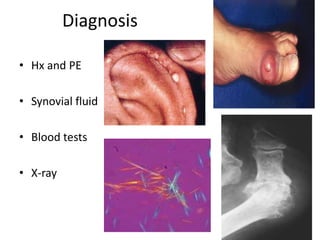 DiagnosisHx and PESynovial fluidBlood testsX-ray