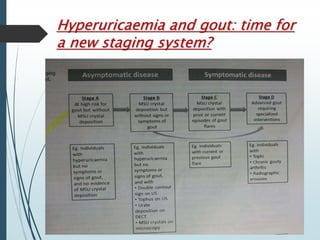 Hyperuricaemia and gout: time for 
a new staging system? 
 