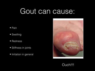 Gout can cause:
• Pain
• Swelling
• Redness
• Stiffness in joints
• Irritation in general

Ouch!!!

 
