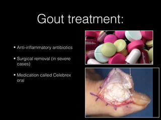 Gout treatment:
• Anti-inflammatory antibiotics
• Surgical removal (in severe
cases)
• Medication called Celebrex
oral

 