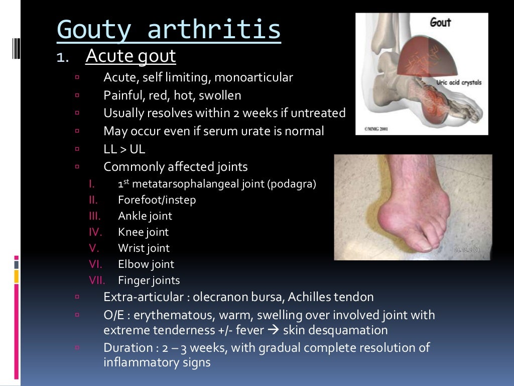 the pathophysiologic presentation of gout