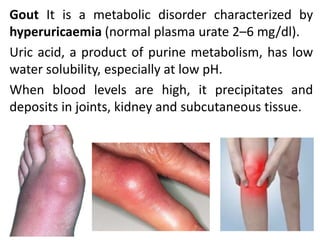 Gout And Rheumatoid Arthritis (Ra)