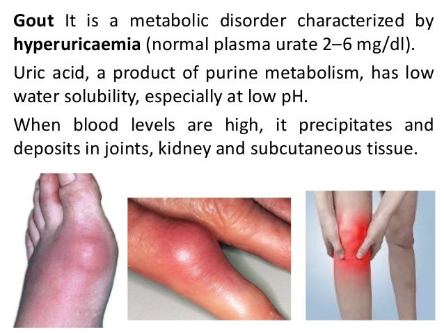 Gout and Rheumatoid arthritis (RA)