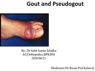 Gout and Pseudogout
By: Dr Sabir kumar khadka
Jr2,Orthopedics,BPKIHS
2020/06/21
Moderator:Dr Rosan Psd Kalawar1
 