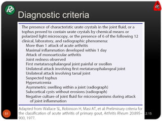 Diagnostic criteria
21.2.15Gout-cs51
 