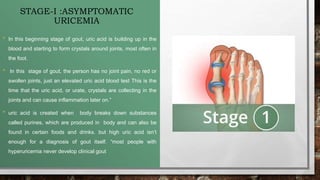 STAGE-I :ASYMPTOMATIC
URICEMIA
• In this beginning stage of gout, uric acid is building up in the
blood and starting to form crystals around joints, most often in
the foot.
• In this stage of gout, the person has no joint pain, no red or
swollen joints, just an elevated uric acid blood test This is the
time that the uric acid, or urate, crystals are collecting in the
joints and can cause inflammation later on.”
• uric acid is created when body breaks down substances
called purines, which are produced in body and can also be
found in certain foods and drinks. but high uric acid isn’t
enough for a diagnosis of gout itself. “most people with
hyperuricemia never develop clinical gout
 