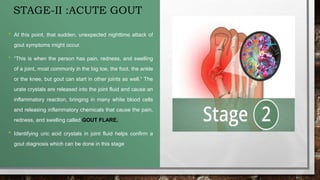 STAGE-II :ACUTE GOUT
• At this point, that sudden, unexpected nighttime attack of
gout symptoms might occur.
• “This is when the person has pain, redness, and swelling
of a joint, most commonly in the big toe, the foot, the ankle
or the knee, but gout can start in other joints as well.“ The
urate crystals are released into the joint fluid and cause an
inflammatory reaction, bringing in many white blood cells
and releasing inflammatory chemicals that cause the pain,
redness, and swelling called GOUT FLARE.
• Identifying uric acid crystals in joint fluid helps confirm a
gout diagnosis which can be done in this stage
 
