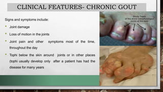 CLINICAL FEATURES- CHRONIC GOUT
Signs and symptoms include:
• Joint damage
• Loss of motion in the joints
• Joint pain and other symptoms most of the time,
throughout the day
• Tophi below the skin around joints or in other places
(tophi usually develop only after a patient has had the
disease for many years
 